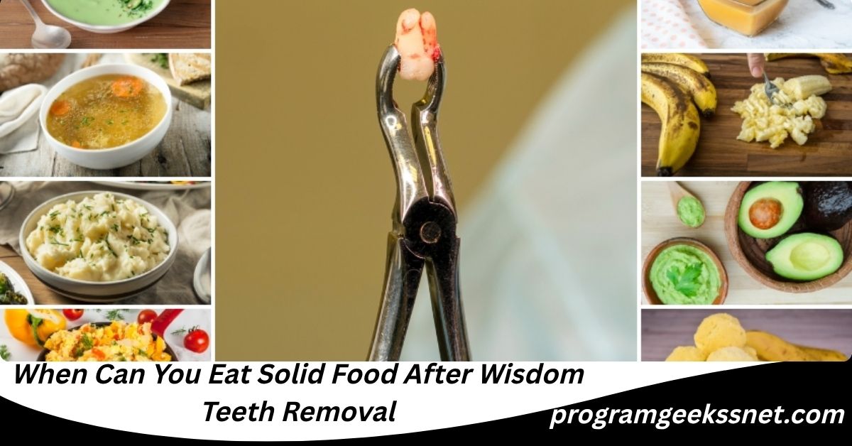 When Can You Eat Solid Food After Wisdom Teeth Removal